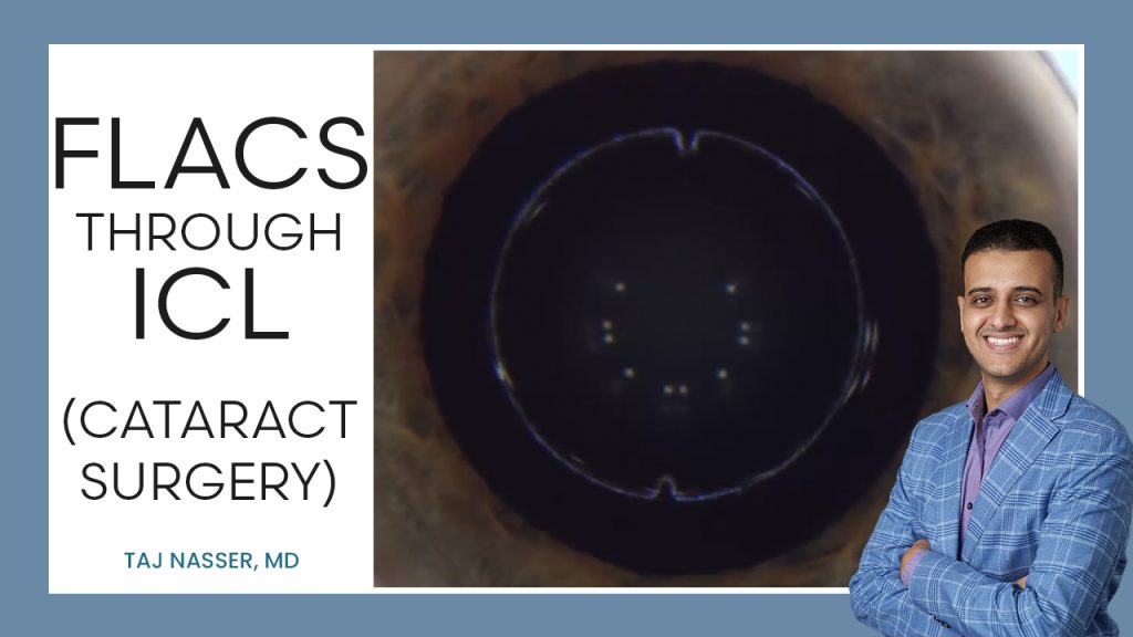 FLACS with ICLs — ICL Workshop