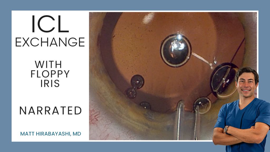 ICL Exchanges — ICL Workshop