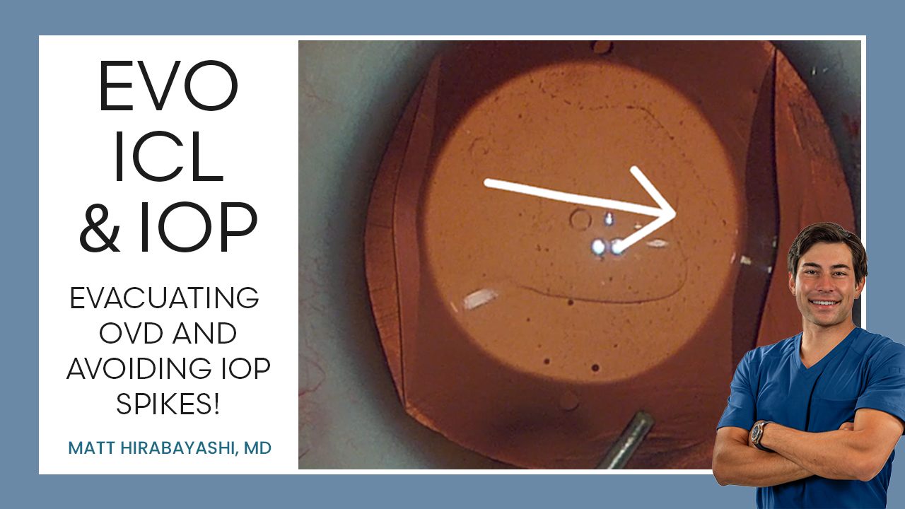 Preventing IOP Spikes — ICL Workshop