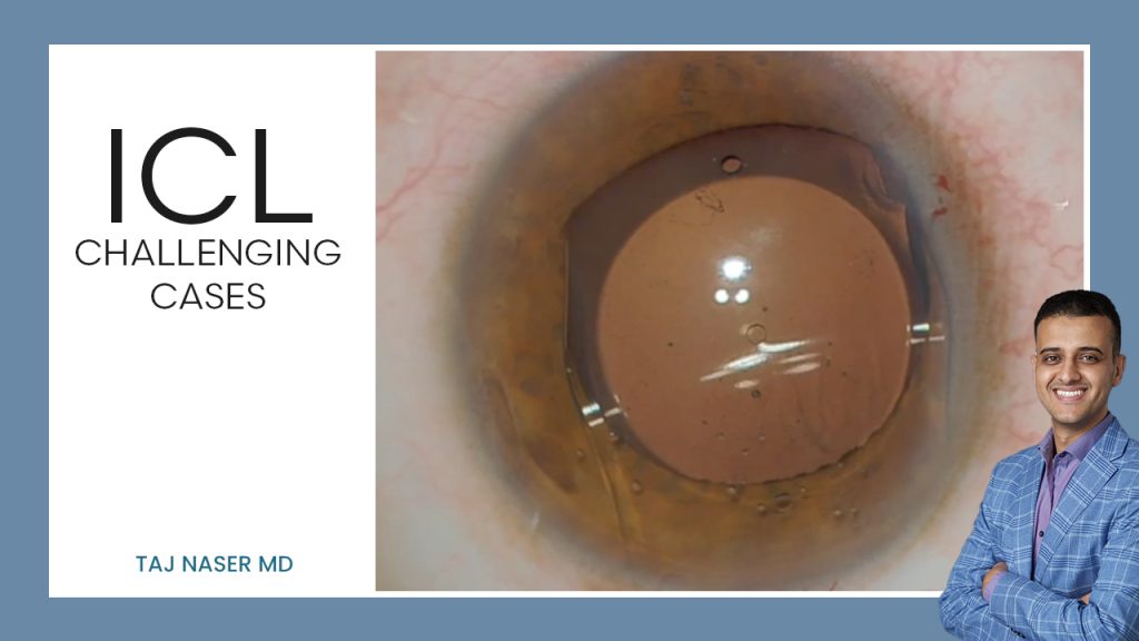 Challenging Cases — ICL Workshop