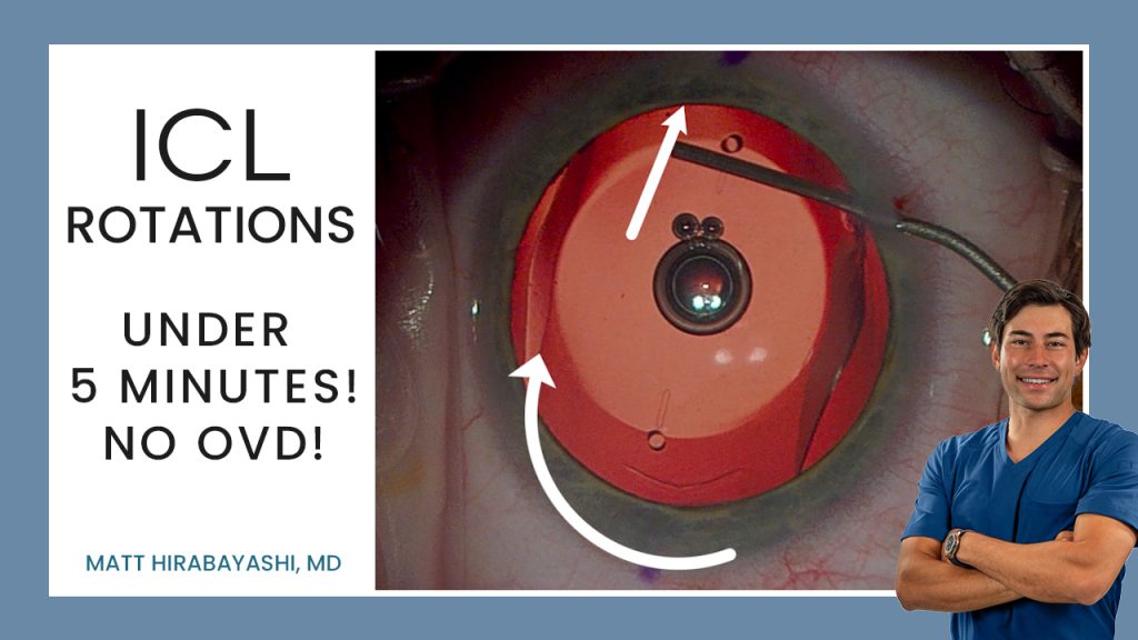 Toric ICL Rotations — ICL Workshop