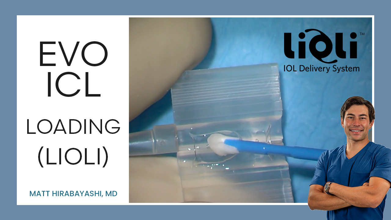 ICL Loading (lioli) — ICL Workshop