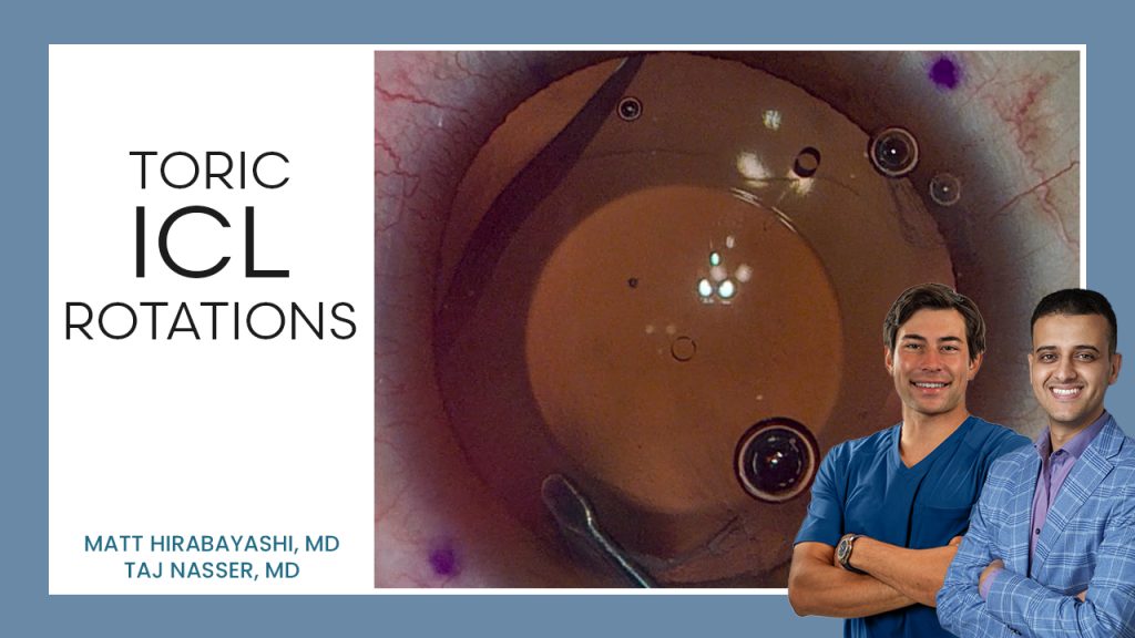 Toric ICL Rotations (Advanced) — ICL Workshop